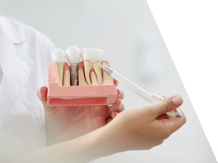 Dentist using model smile to explain the benefits of dental implants