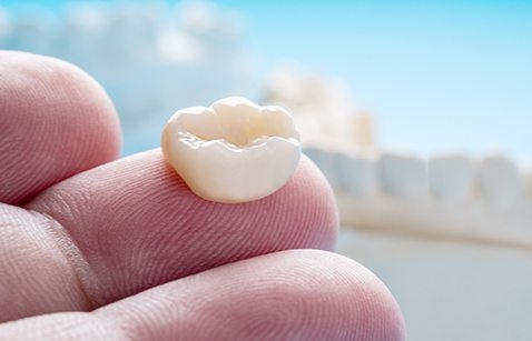 Dental crown sitting on a person’s finger