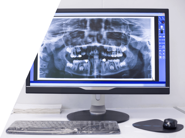 All digital x rays on chairside computer monitor