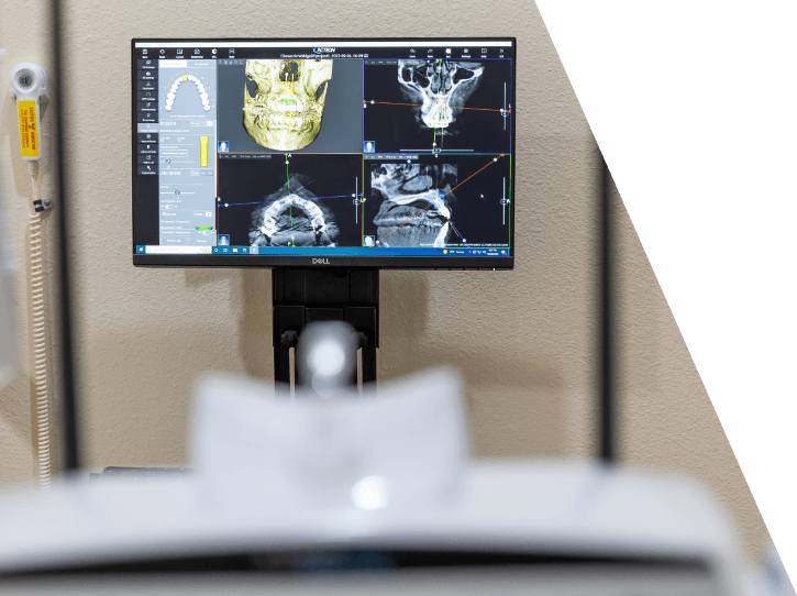 3 D cone beam images on chairside computer monitor