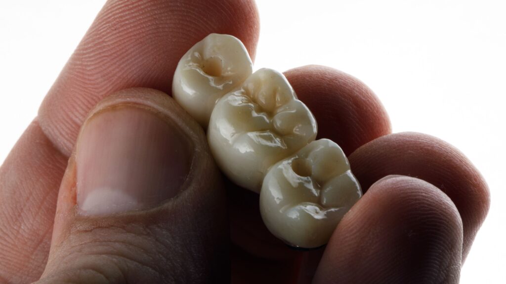 Fingers holding dental bridge