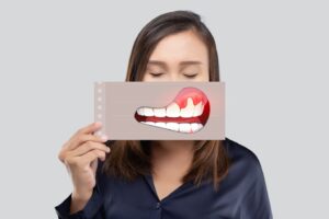 Woman with closed eyes holding illustration of gum disease over her mouth.