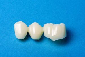 Close-up of 3 different dental crowns.